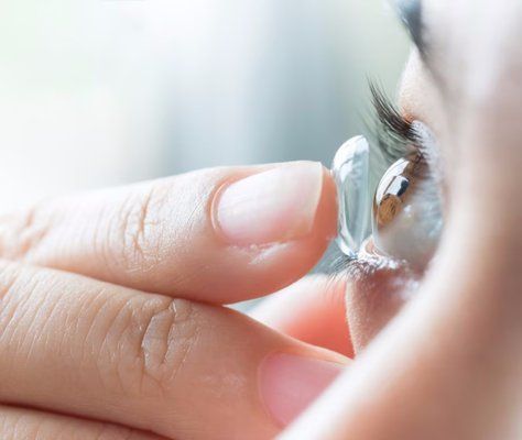Applicazione di una lente a contatto